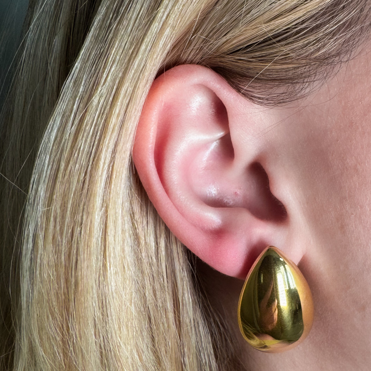 Aretes